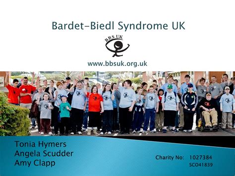 bardet-biedl syndrome uk